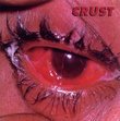 Crust