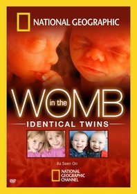 In the Womb: Indentical Twins (Ws)