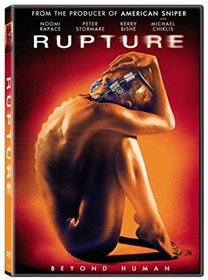 Rupture