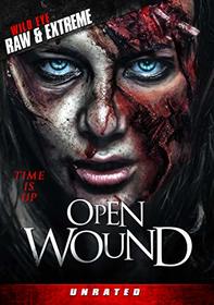 Open Wound