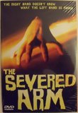 The Severed Arm