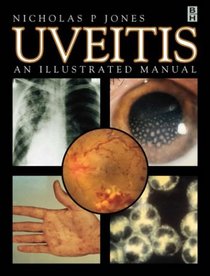 Uveitis: An Illustrated Manual