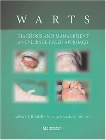 Warts: Diagnosis and Management: An Evidence-based Approach