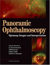 Panoramic Ophthalmoscopy: Optomap Images and Interpretation