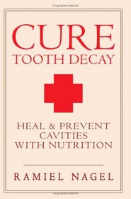 Cure Tooth Decay: Heal and Prevent Cavities with Nutrition