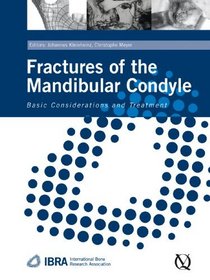 Fractures of the Mandibular Condyle: Basic Considerations and Treatment