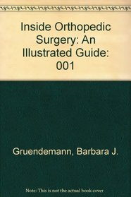 Inside Orthopedic Surgery: An Illustrated Guide