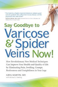 Say Goodbye to Varicose & Spider Veins Now!