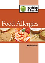 Food Allergies (Nutrition and Health)