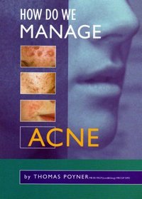 How Do We Manage Acne
