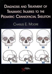 Diagnosis and Treatment of Traumatic Injuries to the Pediatric Craniofacial Skeleton