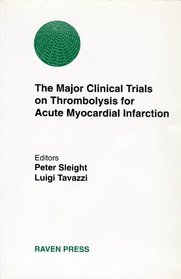 The Major Clinical Trials on Thrombolysis for Acute Myocardial Infarction