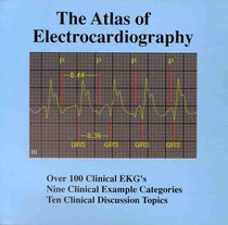 The Atlas of Electrocardiography for Windows, Student Version