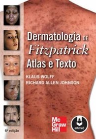Dermatologia De Fitzpatrick Atlas E Texto (Em Portuguese do Brasil)