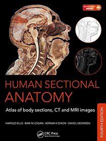 Human Sectional Anatomy: Atlas of Body Sections,CT and MRI Images, Fourth Edition