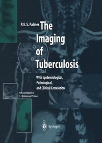 The Imaging of Tuberculosis: With Epidemiological, Pathological, and Clinical Correlation