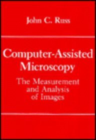 Computer-Assisted Microscopy : The Measurement and Analysis of Images