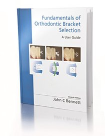 Fundamentals of Orthodontic Bracket Selection: A User Guide