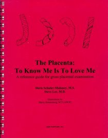 The Placenta: To Know Me Is To Love Me. A Reference Guide for Gross Placental Examination