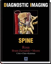 Diagnostic Imaging: Spine (Diagnostic Imaging (W.B. Saunders))