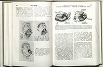 Otolaryngology: Head and Neck v. 3