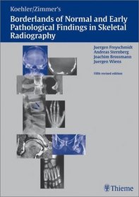 Koehler/Zimmer's Borderlands of Normal and Early Pathological Findings in Skeletal Radiography