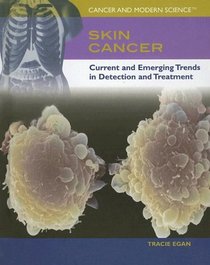 Skin Cancer: Current And Emerging Trends in Detection And Treatment (Cancer and Modern Science)