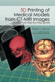 3D Printing of Medical Models from CT-MRI Images