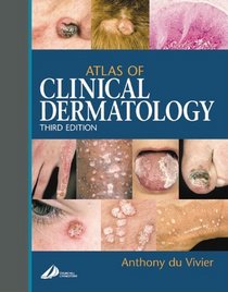 Atlas of Clinical Dermatology