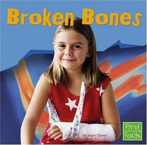Broken Bones (First Facts)