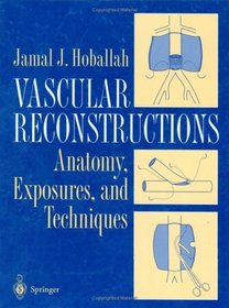 Vascular Reconstruction : Anatomy, Exposure and Techniques