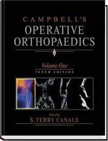 Campbell's Operative Orthopaedics, Four Volume Set