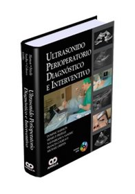 Ultrasonido perioperatorio diagnostico e interventivo (Spanish Edition)