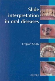 Slide Interpretation in Oral Disease (Oxford Medical Publications)