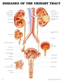 Diseases of the Urinary Tract Anatomical Chart