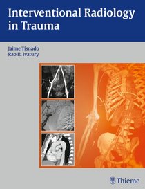 Interventional Radiology in Trauma