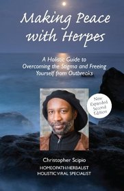 Making Peace with Herpes: A Holistic Guide to Overcomi the Stigma and Freeing Yourself from Outbreaks