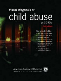 Visual Diagnosis of Child Abuse on CD-ROM