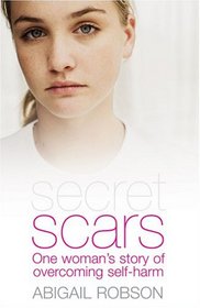 Secret Scars: One woman's story of overcoming self-harm