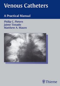 Venous Catheters: A Practical Manual