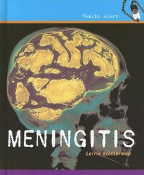 Meningitis (Health Aleart)