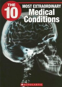The 10 Most Extraordinary Medical Conditions (The Ten)