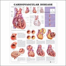 Cardiovascular Disease Anatomical Chart