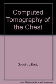 Computed Tomography of the Chest