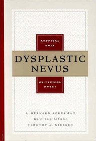 Dysplastic Nevus: A Typical Mole or Typical Myth