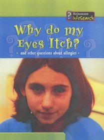 Why Do My Eyes Itch? (Body Matters)