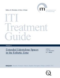 ITI Treatment Guide, Vol 6: Extended Edentulous Spaces in the Esthetic Zone