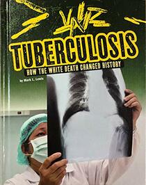 Tuberculosis: How the White Death Changed History (Infected!)