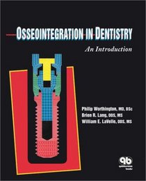 Osseointegration in Dentistry: An Introduction