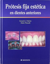 Protesis Fija Estetica En Dientes Anteriores (Spanish Edition)